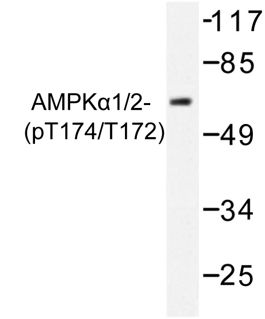 PRKAA1 + PRKAA2 Antibody - Western blot of p-AMPK alpha 1/2 (T183/172) pAb in extracts from COS7 cells treated with heat shock.