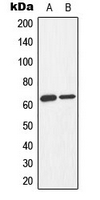 PRKAA1 + PRKAA2 Antibody - Western blot analysis of AMPK alpha 1/2 (pT183/172) expression in Jurkat Adriamycin-treated (A); K562 Adriamycin-treated (B) whole cell lysates.