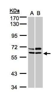 PRKAA2 / AMPK Alpha 2 Antibody - Sample (30 ug whole cell lysate). A: A431, B: MOLT4 . 7.5% SDS PAGE. PRKAA2 antibody diluted at 1:1000