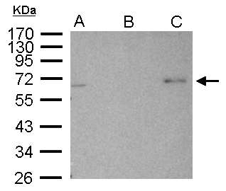 PRKAA2 / AMPK Alpha 2 Antibody - AMPK alpha 2 antibody immunoprecipitates AMPK alpha 2 protein in IP experiments. IP Sample:1000 ug 293T whole cell lysate/extract A. 30 ug 293T whole cell lysate/extract B. Control with 2.5 ug of preimmune rabbit IgG C. Immunoprecipitation of AMPK alpha 2 protein by 2.5 ug of AMPK alpha 2 antibody 10% SDS-PAGE The immunoprecipitated AMPK alpha 2 protein was detected by AMPK alpha 2 antibody diluted at 1:1000. EasyBlot anti-rabbit IgG (anti-rabbit IgG (HRP) -01) was used as a secondary reagent.