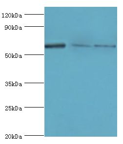 PRKAA2 / AMPK Alpha 2 Antibody - Western blot. All lanes: PRKAA2 antibody at 8 ug/ml. Lane 1: HeLa whole cell lysate. Lane 2: K562 whole cell lysate. Lane 3: MCF-7 whole cell lysate. Secondary antibody: Goat polyclonal to rabbit at 1:10000 dilution. Predicted band size: 62 kDa. Observed band size: 62 kDa.