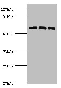 PRKAA2 / AMPK Alpha 2 Antibody - Western blot All lanes: PRKAA2 antibody at 8µg/ml Lane 1: Hela whole cell lysate Lane 2: K562 whole cell lysate Lane 3: MCF-7 whole cell lysate Secondary Goat polyclonal to rabbit IgG at 1/10000 dilution Predicted band size: 62 kDa Observed band size: 62 kDa