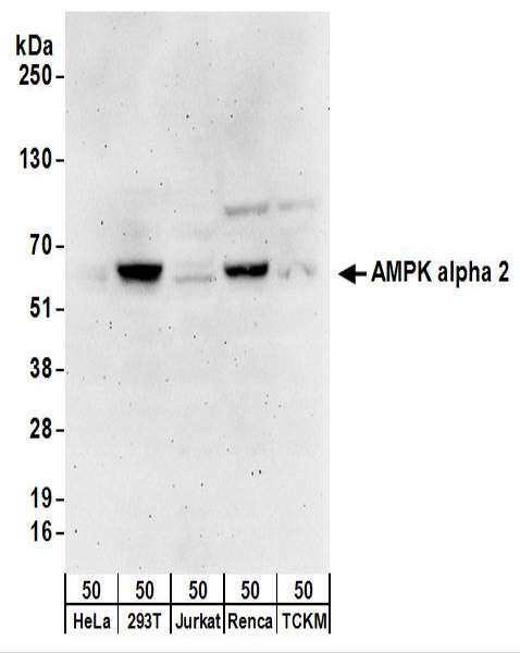 PRKAA2 / AMPK Alpha 2 Antibody - Detection of Human and Mouse AMPK alpha 2 by Western Blot. Samples: Whole cell lysate (50 ug) from HeLa, 293T, Jurkat, mouse Renca, and mouse TCMK-1 cells. Antibodies: Affinity purified rabbit anti-AMPK alpha 2 antibody used for WB at 0.4 ug/ml. Detection: Chemiluminescence with an exposure time of 3 minutes.