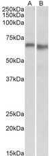 PRKAA2 / AMPK Alpha 2 Antibody - Goat Anti-PRKAA2 Antibody (0.3µg/ml) staining of Mouse (A) and Rat (B) Heart lysate (35µg protein in RIPA buffer). Detected by chemiluminescencence.