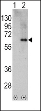PRKAA2 / AMPK Alpha 2 Antibody - Western blot of PRKAA2 (arrow) using rabbit polyclonal PRKAA2 Antibody (RB11657). 293 cell lysates (2 ug/lane) either nontransfected (Lane 1) or transiently transfected with the PRKAA2 gene (Lane 2) (Origene Technologies).