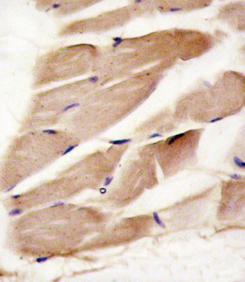 PRKAA2 / AMPK Alpha 2 Antibody - Formalin-fixed and paraffin-embedded human skeletal muscle reacted with PRKAA2 antibody , which was peroxidase-conjugated to the secondary antibody, followed by DAB staining. This data demonstrates the use of this antibody for immunohistochemistry; clinical relevance has not been evaluated.