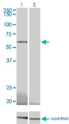 PRKAA2 / AMPK Alpha 2 Antibody - Western blot analysis of PRKAA2 over-expressed 293 cell line, cotransfected with PRKAA2 Validated Chimera RNAi (Lane 2) or non-transfected control (Lane 1). Blot probed with PRKAA2 monoclonal antibody (M02) clone 1G8 . GAPDH ( 36.1 kDa ) used as specificity and loading control.