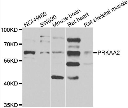 PRKAA2 / AMPK Alpha 2 Antibody - Western blot analysis of extracts of various cell lines.
