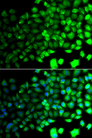PRKAA2 / AMPK Alpha 2 Antibody - Immunofluorescence analysis of A549 cells.