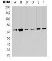 PRKAA2 / AMPK Alpha 2 Antibody - Western blot analysis of AMPK alpha 2 expression in HeLa (A); 293T (B); C2C12 (C); NIH3T3 (D); rat heart (E); rat brain (F) whole cell lysates.