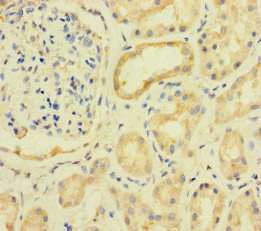 PRKAA2 / AMPK Alpha 2 Antibody - Immunohistochemistry of paraffin-embedded human kidney tissue at dilution of 1:100