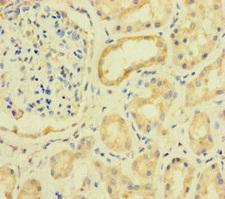 PRKAA2 / AMPK Alpha 2 Antibody - Immunohistochemistry of paraffin-embedded human kidney tissue at dilution of 1:100