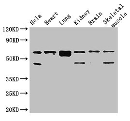 PRKAA2 / AMPK Alpha 2 Antibody - Western Blot Positive WB detected in:Hela whole cell lysate,Mouse heart tissue,Mouse lung tissue,Mouse kidney tissue,Mouse brain tissue,Mouse skeletal muscle tissue All Lanes: PRKAA2 antibody at 2.7ug/ml Secondary Goat polyclonal to rabbit IgG at 1/50000 dilution Predicted band size: 63 kDa Observed band size: 63,48 kDa
