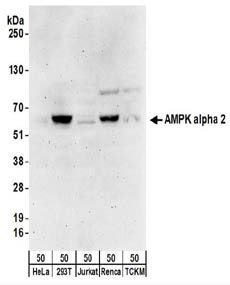 PRKAA2 / AMPK Alpha 2 Antibody - Detection of human and mouse AMPK alpha 2 in whole cell lysates (50 µg) of HeLa, 293T, Jurkat, mouse Renca, and mouse TCMK-1 cells