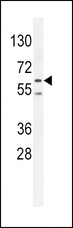 PRKAA2 / AMPK Alpha 2 Antibody - PRKAA2 (Thr172) Antibody western blot of K562 cell line lysates (35 ug/lane). The PRKAA2 antibody detected the PRKAA2 protein (arrow).