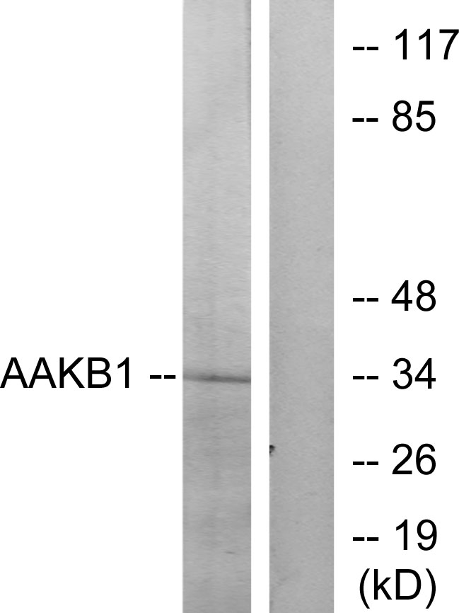 PRKAB1 / AMPK Beta 1 Antibody - Western blot analysis of lysates from Raw264.7 cells, treated with TNF 20ng/ml 5', using PRKAB1 Antibody. The lane on the right is blocked with the synthesized peptide.