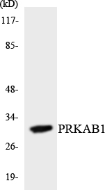 PRKAB1 / AMPK Beta 1 Antibody - Western blot analysis of the lysates from HeLa cells using PRKAB1 antibody.