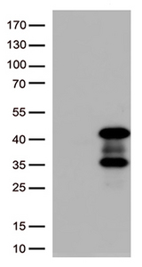 PRKAB1 / AMPK Beta 1 Antibody - HEK293T cells were transfected with the pCMV6-ENTRY control. (Left lane) or pCMV6-ENTRY PRKAB1. (Right lane) cDNA for 48 hrs and lysed. Equivalent amounts of cell lysates. (5 ug per lane) were separated by SDS-PAGE and immunoblotted with anti-PRKAB1. (1:500)