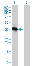 PRKAB1 / AMPK Beta 1 Antibody - Western Blot analysis of PRKAB1 expression in transfected 293T cell line by PRKAB1 monoclonal antibody (M01), clone 3H12-1A10.Lane 1: PRKAB1 transfected lysate(31.05 KDa).Lane 2: Non-transfected lysate.