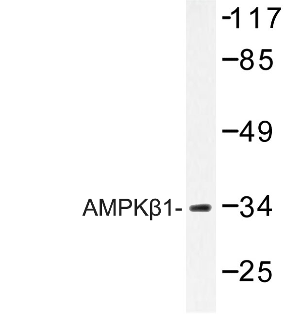 PRKAB1 / AMPK Beta 1 Antibody - Western blot of AMPK1 (H17) pAb in extracts from RAW264.7 treated with TNF 20ng.