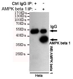 PRKAB1 / AMPK Beta 1 Antibody - Immunoprecipitation analysis of HeLa cell lysates using AMPK beta 1 mouse monoclonal antibody.