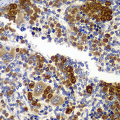 PRKAB1 / AMPK Beta 1 Antibody - Immunohistochemistry of paraffin-embedded rat spleen tissue.