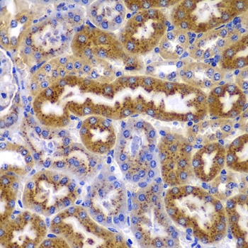 PRKAB1 / AMPK Beta 1 Antibody - Immunohistochemistry of paraffin-embedded mouse kidney tissue.