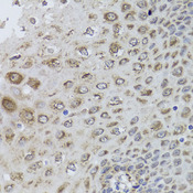 PRKAB1 / AMPK Beta 1 Antibody - Immunohistochemistry of paraffin-embedded human esophagus using PRKAB1 antibody at dilution of 1:100 (40x lens).