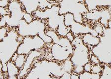 PRKAB1 / AMPK Beta 1 Antibody - 1:100 staining rat lung tissue by IHC-P. The sample was formaldehyde fixed and a heat mediated antigen retrieval step in citrate buffer was performed. The sample was then blocked and incubated with the antibody for 1.5 hours at 22°C. An HRP conjugated goat anti-rabbit antibody was used as the secondary.