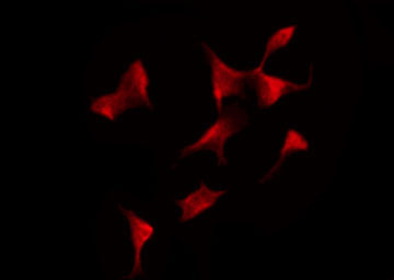 PRKAB1 / AMPK Beta 1 Antibody - Staining HeLa cells by IF/ICC. The samples were fixed with PFA and permeabilized in 0.1% Triton X-100, then blocked in 10% serum for 45 min at 25°C. The primary antibody was diluted at 1:200 and incubated with the sample for 1 hour at 37°C. An Alexa Fluor 594 conjugated goat anti-rabbit IgG (H+L) Ab, diluted at 1/600, was used as the secondary antibody.