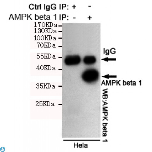PRKAB1 / AMPK Beta 1 Antibody - Immunoprecipitation analysis of Hela cell lysates using AMPK beta 1 mouse mAb.