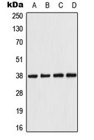 PRKAB1 / AMPK Beta 1 Antibody - Western blot analysis of AMPK beta 1 expression in HeLa (A); Raw264.7 (B); PC12 (C); rat kidney (D) whole cell lysates.
