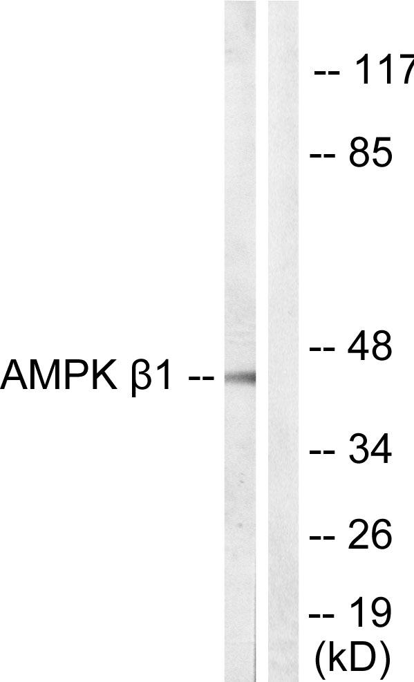 PRKAB1 / AMPK Beta 1 Antibody - Western blot analysis of extracts from COS7 cells, using AMPK ß1 (Ab-181) Antibody.