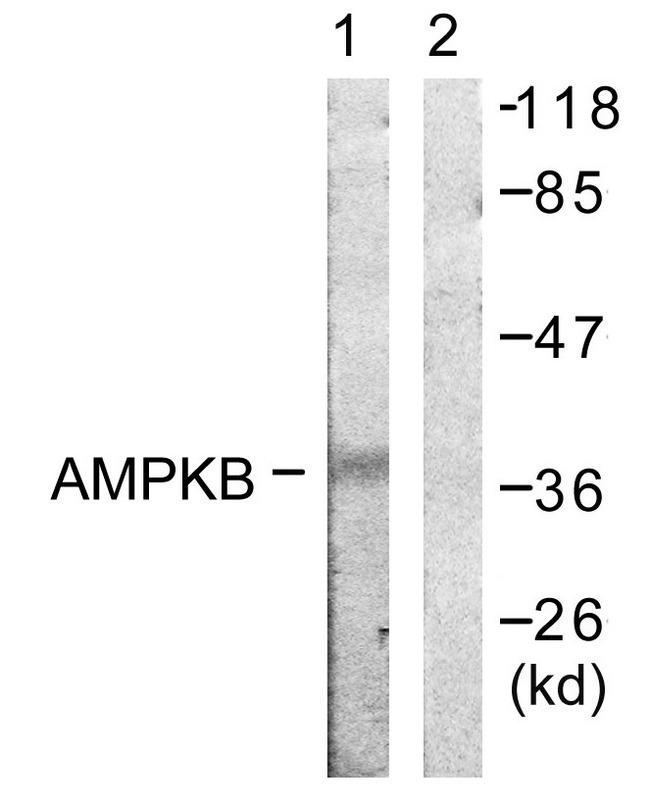 PRKAB1 / AMPK Beta 1 Antibody - Western blot analysis of extracts from K562 cells, using AMPK ß1 (Ab-181) antibody.