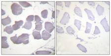 PRKAB1 / AMPK Beta 1 Antibody - Immunohistochemistry analysis of paraffin-embedded human skeletal muscle, using AMPK beta1 (Phospho-Ser181) Antibody. The picture on the right is blocked with the phospho peptide.