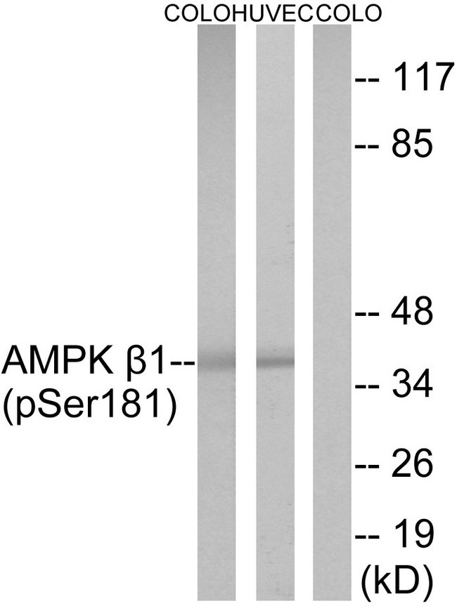 PRKAB1 / AMPK Beta 1 Antibody - Western blot analysis of lysates from COLO205 cells and HUVEC cells, using AMPK beta1 (Phospho-Ser181) Antibody. The lane on the right is blocked with the phospho peptide.