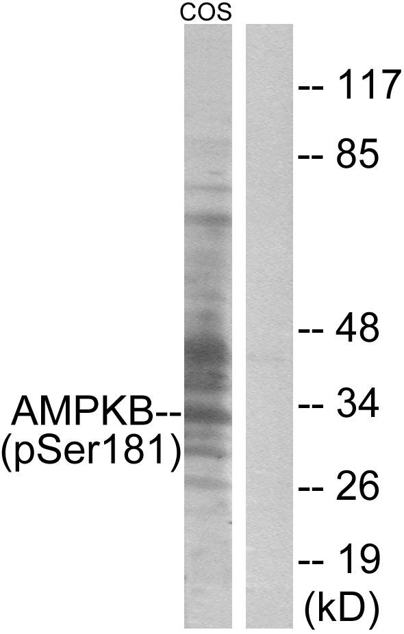 PRKAB1 / AMPK Beta 1 Antibody - Western blot analysis of extracts from COS7 cells treated with PMA (125ng/ml, 30mins), using AMPK ß1 (Phospho-Ser181) antibody.