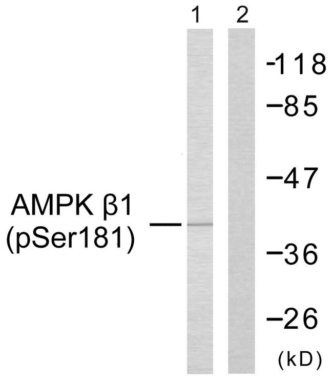PRKAB1 / AMPK Beta 1 Antibody - Western blot analysis of extracts from Jurkat cells, using AMPK ß1 (Phospho-Ser181) Antibody.