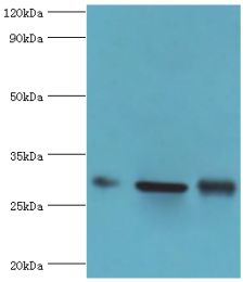 PRKAB2 / AMPK Beta 2 Antibody - Western blot. All lanes: PRKAB2 antibody at 5 ug/ml. Lane 1: rat brain tissue. Lane 2: mouse heart tissue. Lane 3: mouse gonad tissue. Secondary antibody: Goat polyclonal to rabbit at 1:10000 dilution. Predicted band size: 30 kDa. Observed band size: 30 kDa.