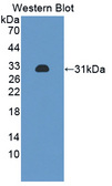 PRKAB2 / AMPK Beta 2 Antibody - Western blot of PRKAB2 / AMPK Beta 2 antibody.