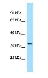 PRKAB2 / AMPK Beta 2 Antibody - PRKAB2 / AMPK Beta 2 antibody Western Blot of Rat Muscle.  This image was taken for the unconjugated form of this product. Other forms have not been tested.