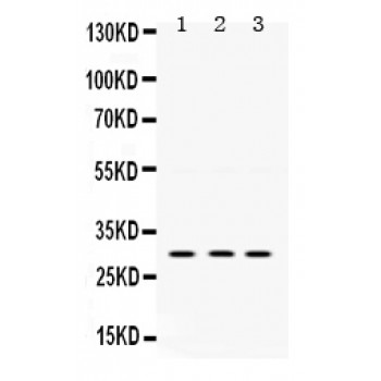 PRKAB2 / AMPK Beta 2 Antibody - AMPK beta 2 antibody Western blot. All lanes: Anti AMPK beta 2 at 0.5 ug/ml. Lane 1: Rat Brain Tissue Lysate at 50 ug. Lane 2: Rat Skeletal Muscle Tissue Lysate at 50 ug. Lane 3: PANC Whole Cell Lysate at 40 ug. Predicted band size: 30 kD. Observed band size: 30 kD.