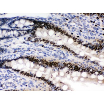 PRKAB2 / AMPK Beta 2 Antibody - AMPK beta 2 antibody IHC-paraffin. IHC(P): Rat Intestine Tissue.