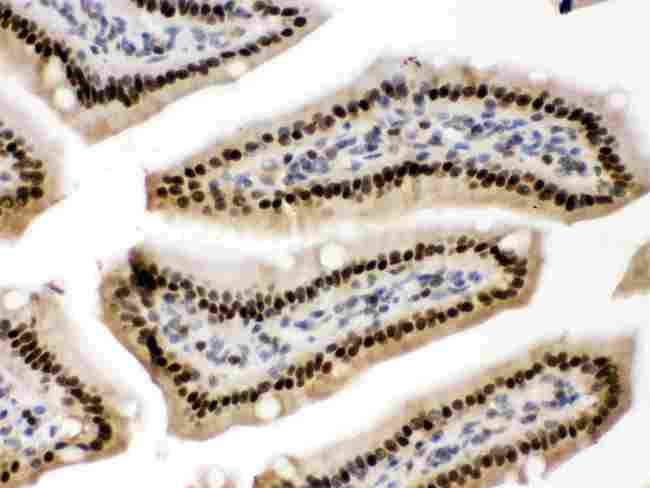 PRKAB2 / AMPK Beta 2 Antibody - anti-AMPK beta 2 Picoband antibody IHC(P): Mouse Intestine Tissue