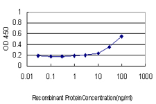 PRKAB2 / AMPK Beta 2 Antibody - Detection limit for recombinant GST tagged PRKAB2 is approximately 10 ng/ml as a capture antibody.
