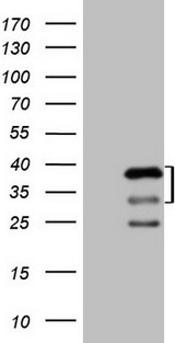 PRKAB2 / AMPK Beta 2 Antibody - HEK293T cells were transfected with the pCMV6-ENTRY control. (Left lane) or pCMV6-ENTRY PRKAB2. (Right lane) cDNA for 48 hrs and lysed. Equivalent amounts of cell lysates. (5 ug per lane) were separated by SDS-PAGE and immunoblotted with anti-PRKAB2. (1:2000)