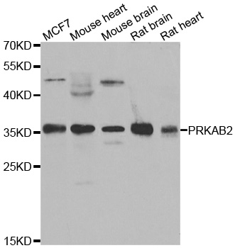 PRKAB2 / AMPK Beta 2 Antibody - Western blot analysis of extracts of various cell lines.