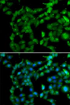 PRKAB2 / AMPK Beta 2 Antibody - Immunofluorescence analysis of U20S cells.
