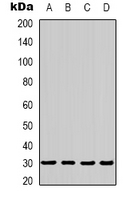 PRKAB2 / AMPK Beta 2 Antibody - Western blot analysis of AMPK beta 2 expression in 293T (A); HepG2 (B); mouse heart (C); rat heart (D) whole cell lysates.