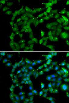PRKAB2 / AMPK Beta 2 Antibody - Immunofluorescence analysis of U2OS cells using PRKAB2 antibody. Blue: DAPI for nuclear staining.
